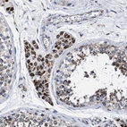 Immunohistochemical staining of human testis shows moderate cytoplasmic positivity in Leydig cells.