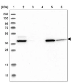 Lane 1: Marker [kDa] 230, 130, 95, 72, 56, 36, 28, 17, 11_br/_Lane 2: Human cell line RT-4_br/_Lane 3: Human cell line U-251MG sp_br/_Lane 4: Human plasma (IgG/HSA depleted)_br/_Lane 5: Human liver tissue_br/_Lane 6: Human tonsil tissue