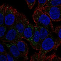 Anti-TSPAN8 Antibody