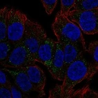 Anti-TSPAN8 Antibody