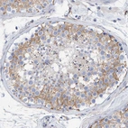 Immunohistochemical staining of human testis shows moderate membranous positivity in cells in seminiferous ducts.