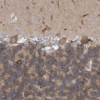 Immunohistochemical staining of human cerebellum shows moderate to strong membranous positivity in cells in granular layer.