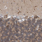 Immunohistochemical staining of human cerebellum shows moderate to strong membranous positivity in cells in granular layer.