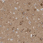 Immunohistochemical staining of human cerebral cortex shows moderate to strong cytoplasmic positivity in neurons.