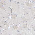 Immunohistochemical staining of human skeletal muscle shows low positivity in myocytes as expected.