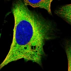 Immunofluorescent staining of human cell line U-2 OS shows localization to cytosol.