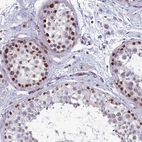 Anti-RGS17 Antibody
