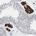Anti-PPM1D Antibody