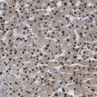 Immunohistochemical staining of human liver shows moderate to strong nuclear positivity in hepatocytes.