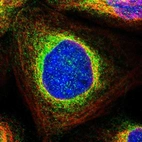 Immunofluorescent staining of human cell line A-431 shows localization to endoplasmic reticulum.