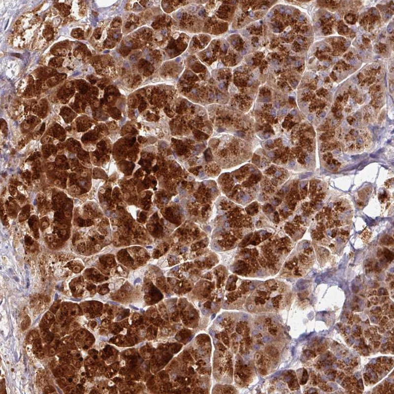 Anti-AEBP2 Antibody