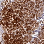 Anti-AEBP2 Antibody