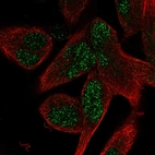 Immunofluorescent staining of human cell line RH-30 shows localization to nucleus.