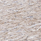 Anti-ZNF462 Antibody