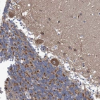 Anti-TWISTNB Antibody