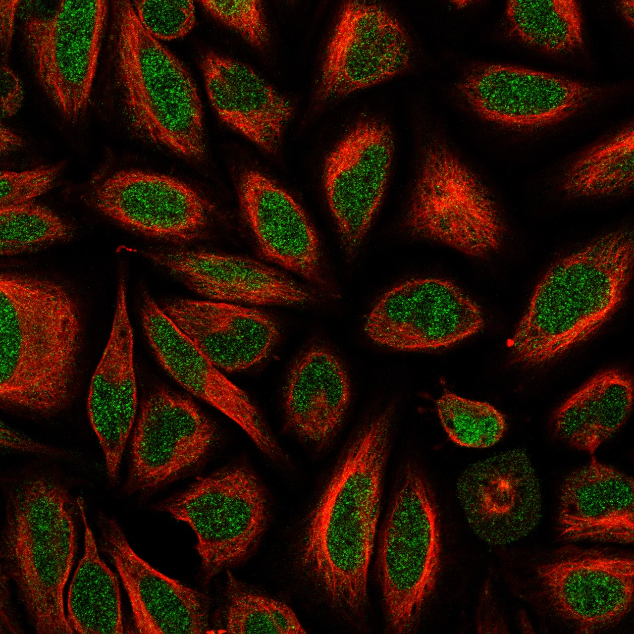 Anti-ERCC6L2 Antibody