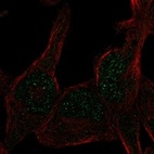 Anti-ERCC6L2 Antibody