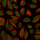 Anti-ERCC6L2 Antibody