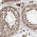 Anti-PKD1L1 Antibody