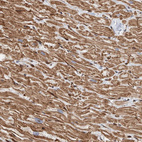 Immunohistochemical staining of human heart shows moderate cytoplasmic positivity in cardiomyocytes.