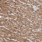 Immunohistochemical staining of human heart shows moderate cytoplasmic positivity in cardiomyocytes.