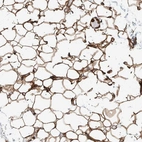 Immunohistochemical staining of human adipose tissue shows strong membranous positivity in adipocytes.