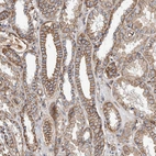 Immunohistochemical staining of human kidney shows moderate membranous positivity in cells in tubules.