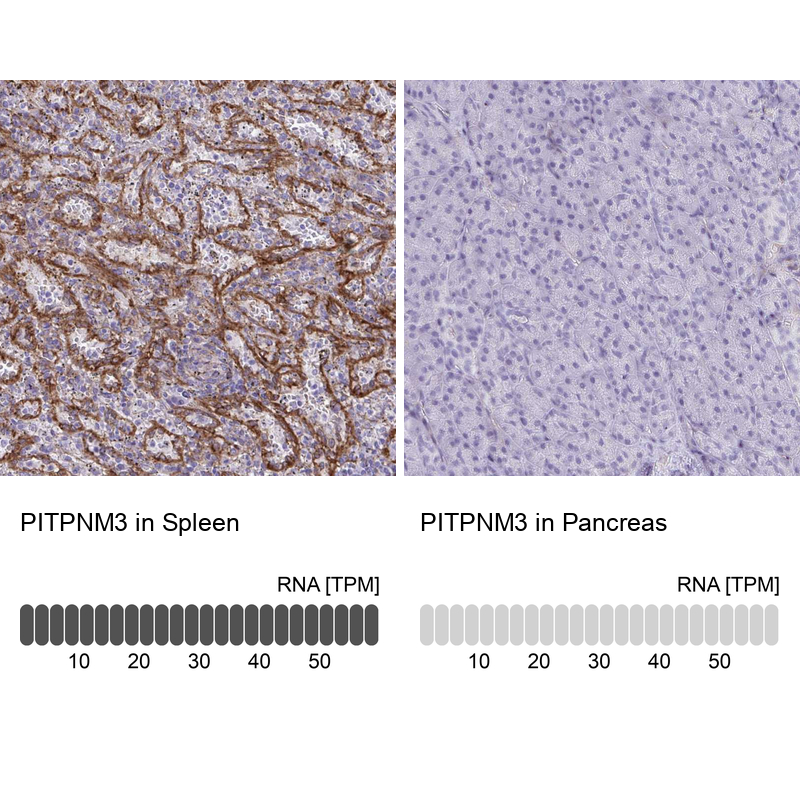 Anti-PITPNM3 Antibody