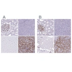 Immunohistochemical staining of human kidney, pancreas, skeletal muscle and spleen using Anti-PITPNM3 antibody HPA022432 (A) shows similar protein distribution across tissues to independent antibody HPA059005 (B).
