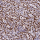 Immunohistochemical staining of human spleen shows strong membranous positivity in sinusoids.