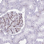 Immunohistochemical staining of human kidney shows strong membranous positivity in cells in glomeruli.