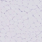 Immunohistochemical staining of human skeletal muscle shows no positivity in myocytes as expected.