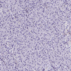 Anti-PITPNM3 Antibody