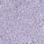 Immunohistochemical staining of human pancreas shows no positivity in exocrine glandular cells as expected.