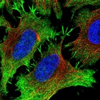 Immunofluorescent staining of human cell line HeLa shows localization to plasma membrane.