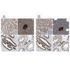 Anti-ACLY Antibody