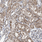 Immunohistochemical staining of human kidney shows moderate cytoplasmic positivity in cells in tubules.