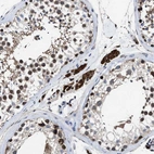Immunohistochemical staining of human testis shows strong cytoplasmic positivity in Leydig cells.