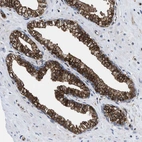 Immunohistochemical staining of human prostate shows strong cytoplasmic positivity in glandular cells.