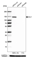 Western blot analysis in A-549 cells transfected with control siRNA, target specific siRNA probe #1 and #2, using Anti-ACLY antibody. Remaining relative intensity is presented. Loading control: Anti-GAPDH.