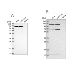 Western blot analysis using Anti-ACLY antibody HPA022434 (A) shows similar pattern to independent antibody HPA022953 (B).