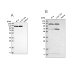 Western blot analysis using Anti-ACLY antibody HPA022434 (A) shows similar pattern to independent antibody HPA022953 (B).