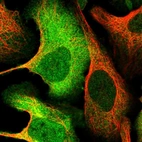 Immunofluorescent staining of human cell line U-2 OS shows localization to nucleoplasm, plasma membrane & cytosol.