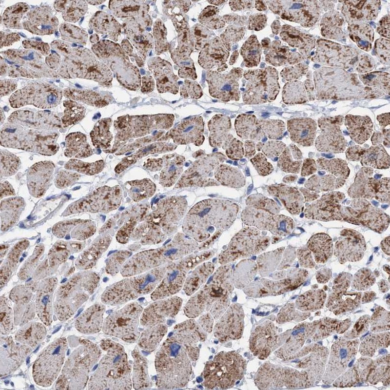 Anti-RSAD1 Antibody