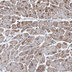 Anti-RSAD1 Antibody