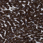 Immunohistochemical staining of human liver shows strong granular cytoplasmic positivity in hepatocytes.