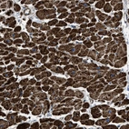 Immunohistochemical staining of human heart muscle shows strong granular cytoplasmic positivity in cardiomyocytes.