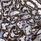 Immunohistochemical staining of human kidney shows strong granular cytoplasmic positivity in cells in tubules.