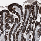 Immunohistochemical staining of human duodenum shows strong granular cytoplasmic positivity in glandular cells.