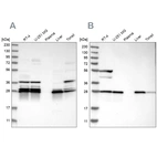 Western blot analysis using Anti-ECHS1 antibody HPA022476 (A) shows similar pattern to independent antibody HPA021995 (B).